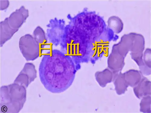 白血病