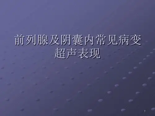 前列腺等超声诊断PPT课件