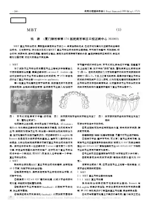 MBT直丝弓矫治技术的矫治机制与临床应用技巧1