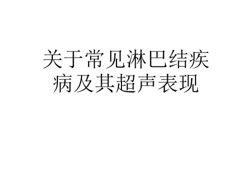 关于常见淋巴结疾病及其超声表现课件