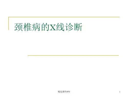 颈椎病X线诊断ppt课件