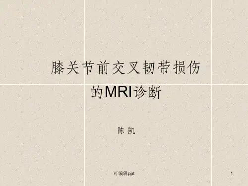 前交叉韧带损伤磁共振诊断