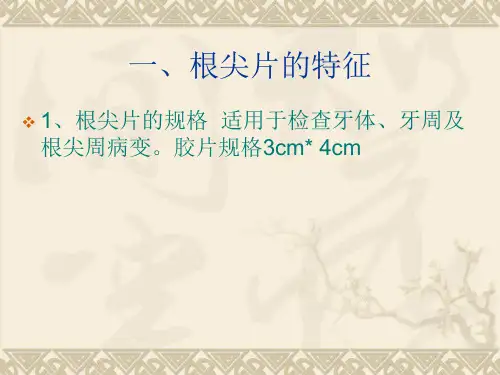 如何拍好根尖片