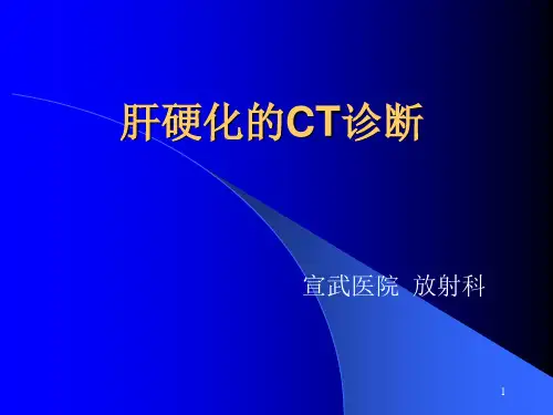 肝硬化的CT诊断PPT参考幻灯片