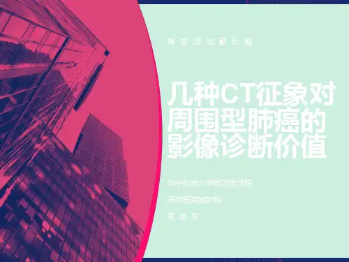 几种CT征象对周围型肺癌的影像诊断价值