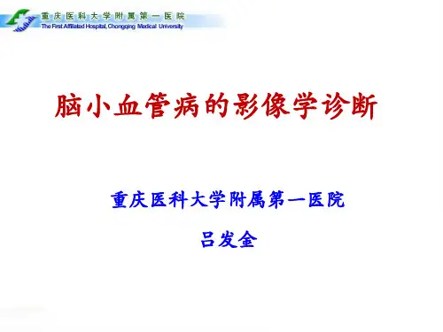 脑小血管病影像学诊断
