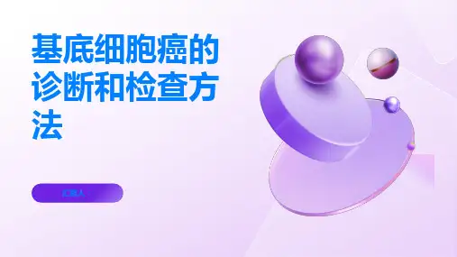 基底细胞癌的诊断和检查方法