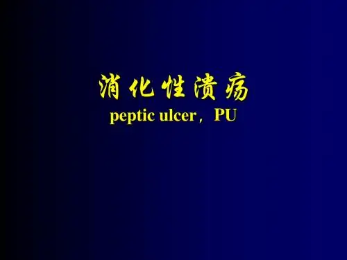 消化性溃疡