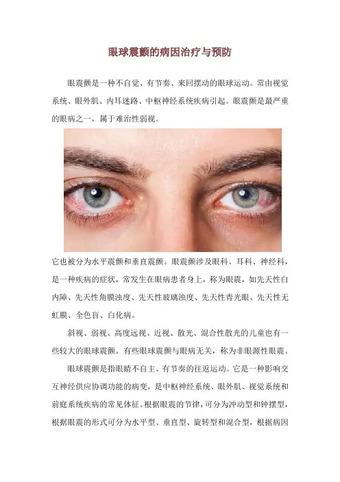 眼球震颤的病因治疗与预防