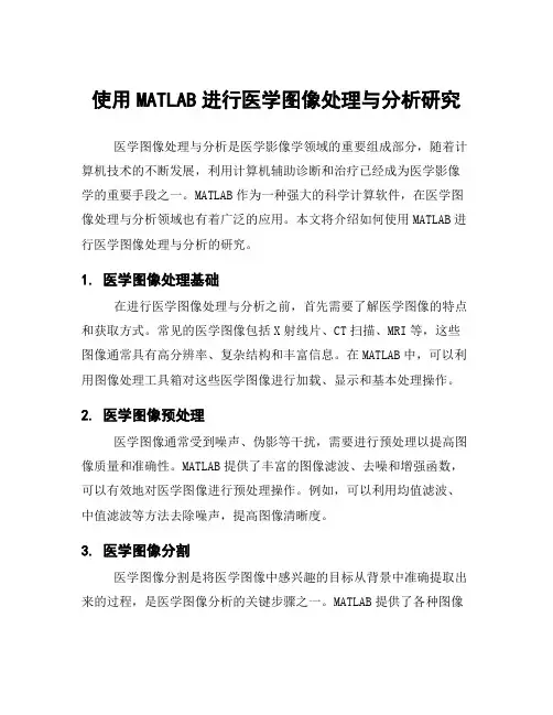 使用MATLAB进行医学图像处理与分析研究