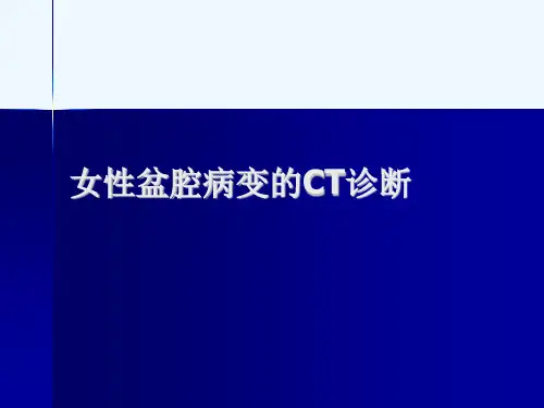 女性盆腔病变的CT诊断[可修改版ppt]