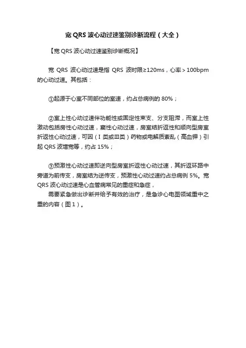 宽QRS波心动过速鉴别诊断流程（大全）