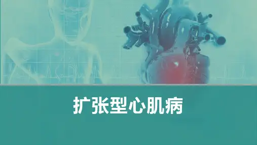 内科学-扩张型心肌病