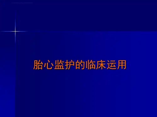 胎心监护的临床运用课件