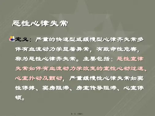 ICU常见恶性心律失常