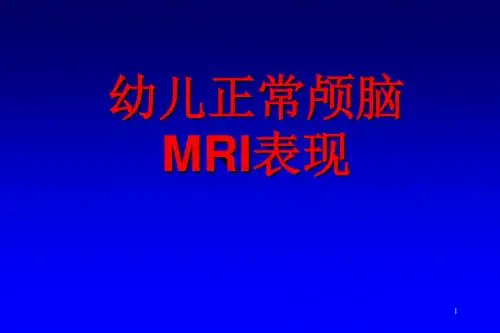 幼儿正常颅脑MRI表现ppt课件