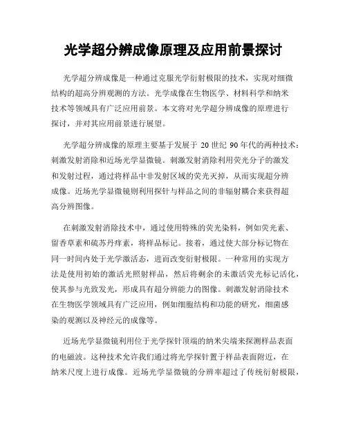 光学超分辨成像原理及应用前景探讨