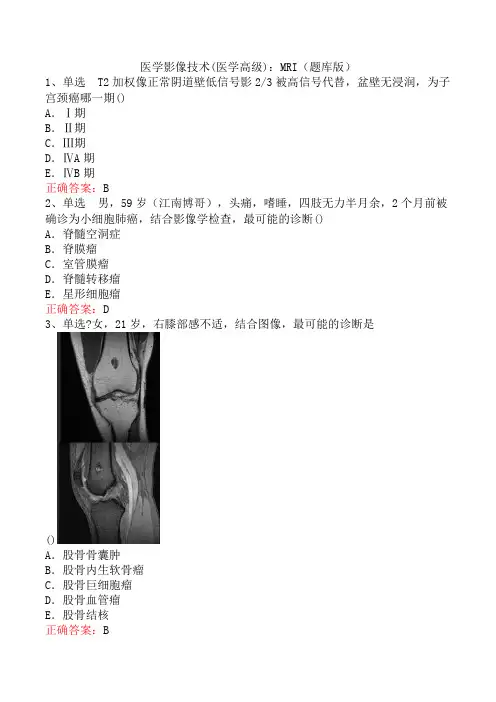 医学影像技术(医学高级)：MRI(题库版)