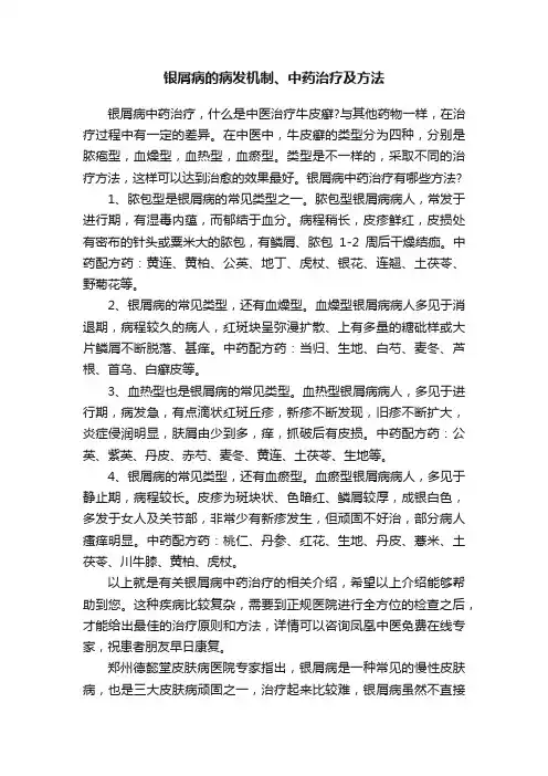 银屑病的病发机制、中药治疗及方法