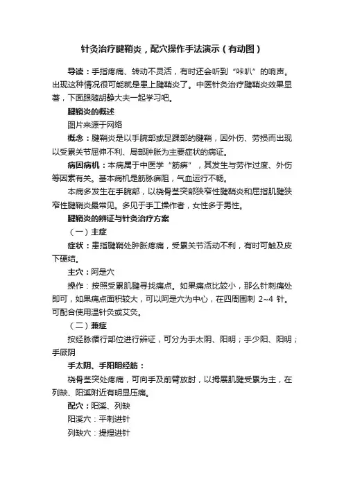 针灸治疗腱鞘炎，配穴操作手法演示（有动图）