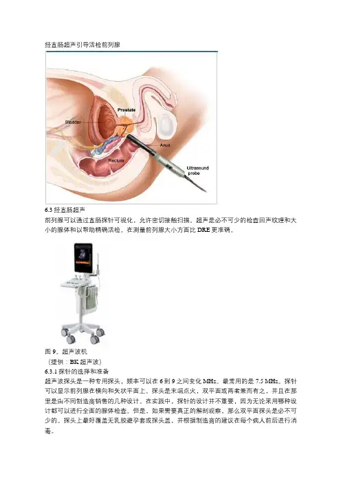 经直肠超声引导活检前列腺的方法及风险分析