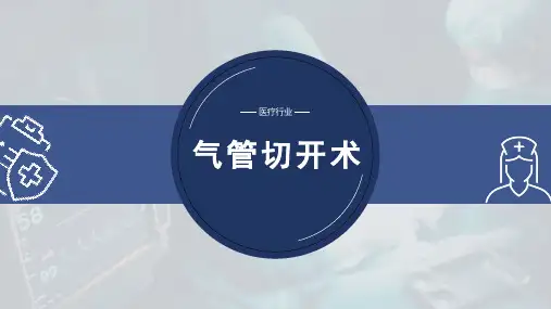 气管切开术 (2)