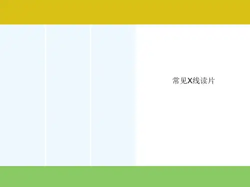 常见X线读片[可修改版ppt]