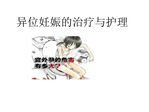 异位妊娠的治疗护理ppt课件