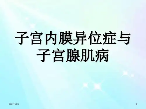 子宫腺肌症PPT课件