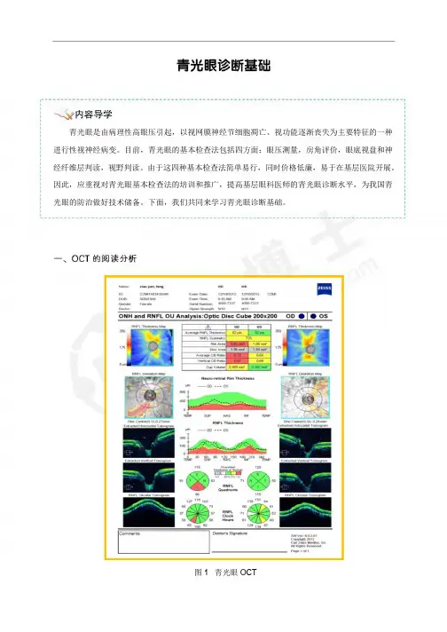 青光眼诊断基础
