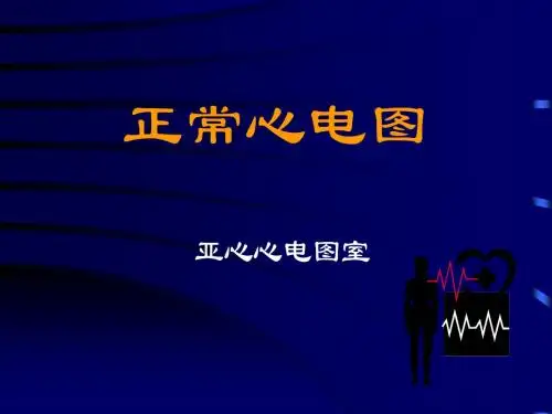 正常心电图