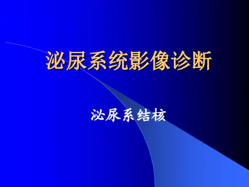 影像诊断学(肾结核)