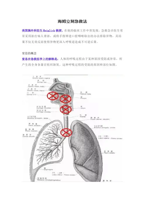 海姆立克急救法详解
