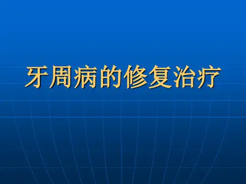 口腔修复学牙周病的修复治疗