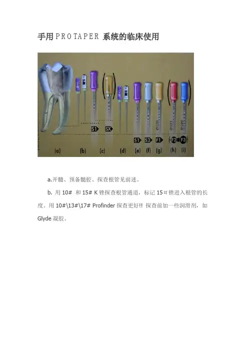 手用PROTAPER系统的临床使用要点