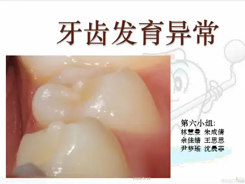牙齿发育异常PPT课件