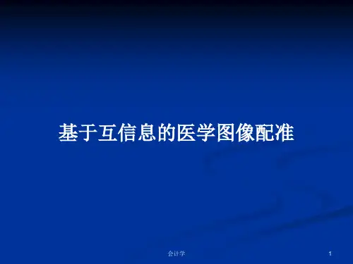 基于互信息的医学图像配准PPT学习教案