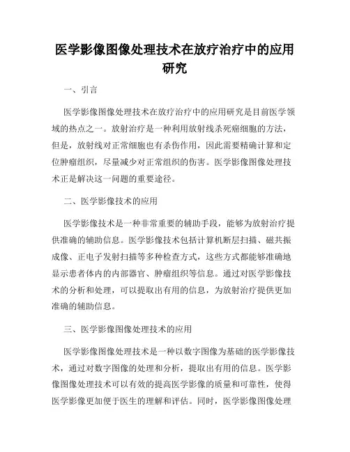 医学影像图像处理技术在放疗治疗中的应用研究