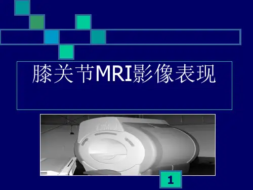膝关节MRI影像表现PPT课件