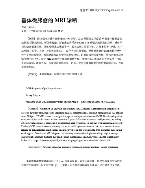 垂体微腺瘤的MRI诊断