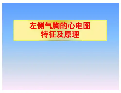 左侧气胸心电图表现课件