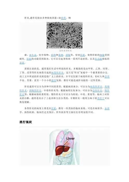 肝炎