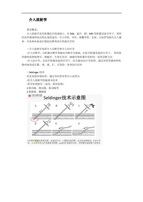 医学影像学总结：介入放射学