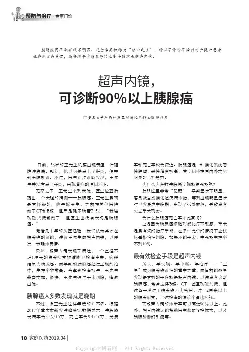 超声内镜,可诊断90%以上胰腺癌
