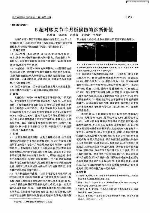 B超对膝关节半月板损伤的诊断价值