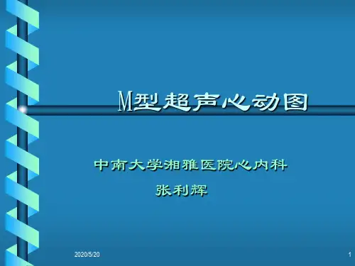 M型超声心动图2