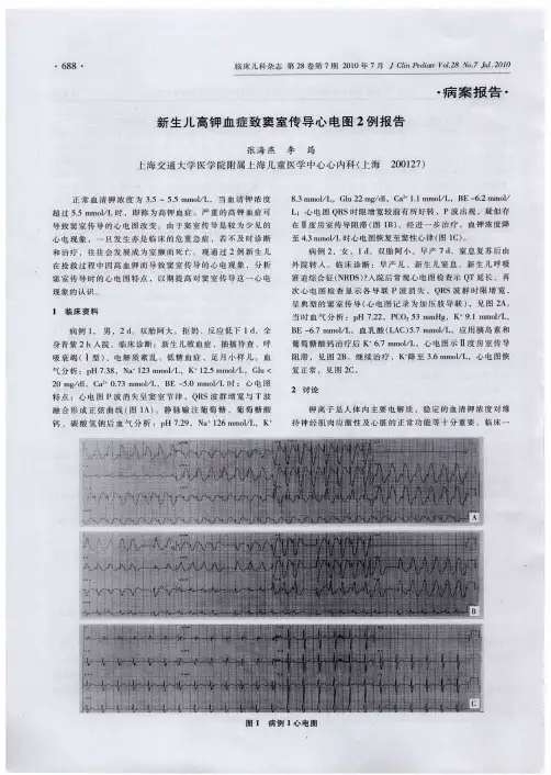 新生儿高钾血症致窦室传导心电图2例报告