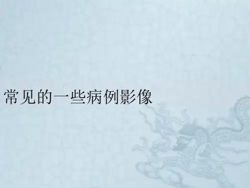 常见的口腔病例影像
