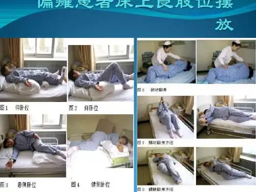 偏瘫患者良肢位摆放