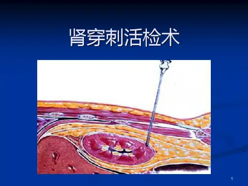 肾穿刺活检术 PPT课件